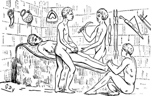 Caesarian Sections Were Performed In Africa Long Before They Were Standardized Across The World